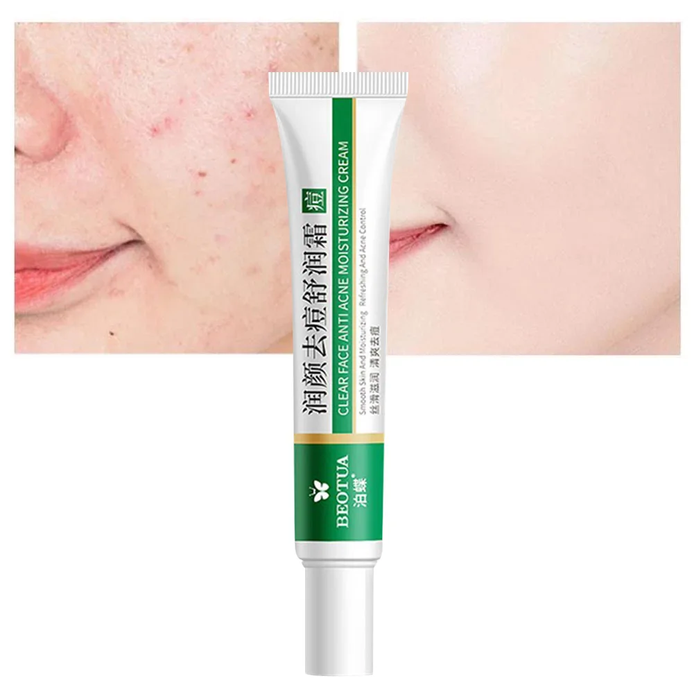 Aloe Vera Acne Whitening Removal Cream Repair Fade Acne Spots Shrink Pores Soothing Moisturizing Acne Treatment Cream Skin Care
Aloe Vera Acne Whitening Removal Cream Repair Fade Acne Spots Shrink Pores Soothing Moisturizing Acne Treatment Cream Skin Care