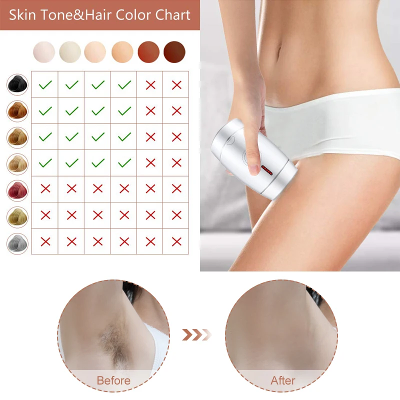 Laser Epilator 800000 Flash Professional Permanent Ipl Hair Removal Photoepilator Home Light Pulses Depilatory Body Face
Laser Epilator 800000 Flash Professional Permanent Ipl Hair Removal Photoepilator Home Light Pulses Depilatory Body Face