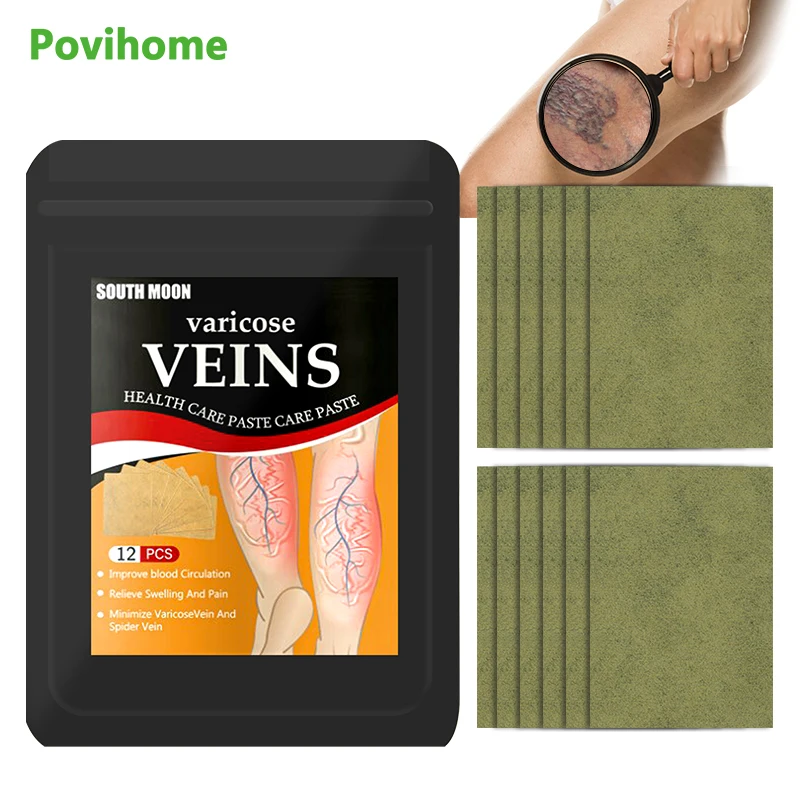 12Pcs Herbal Varicose Veins Detox Patch Varicosity Angiitis Removal Swelling Medical Plaster Vasculitis Phlebitis Spider Sticker
12Pcs Herbal Varicose Veins Detox Patch Varicosity Angiitis Removal Swelling Medical Plaster Vasculitis Phlebitis Spider Sticker
