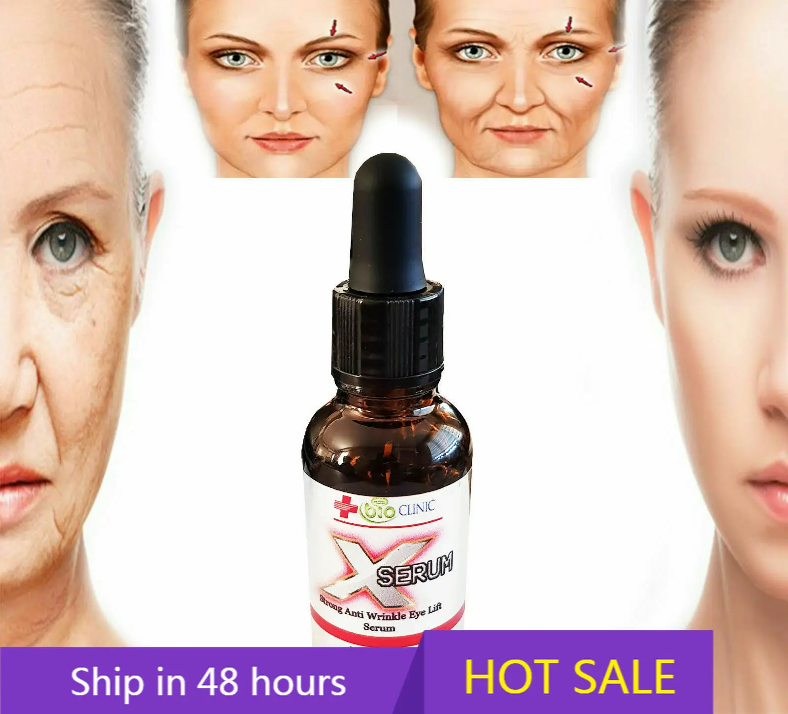 Anti-Aging Creme Lift Anti-Rides Forte, Matrixyl 3000, Acide Hyaluronique, Aloe Vit E Acne Treatment 
Anti-Aging Creme Lift Anti-Rides Forte, Matrixyl 3000, Acide Hyaluronique, Aloe Vit E Acne Treatment