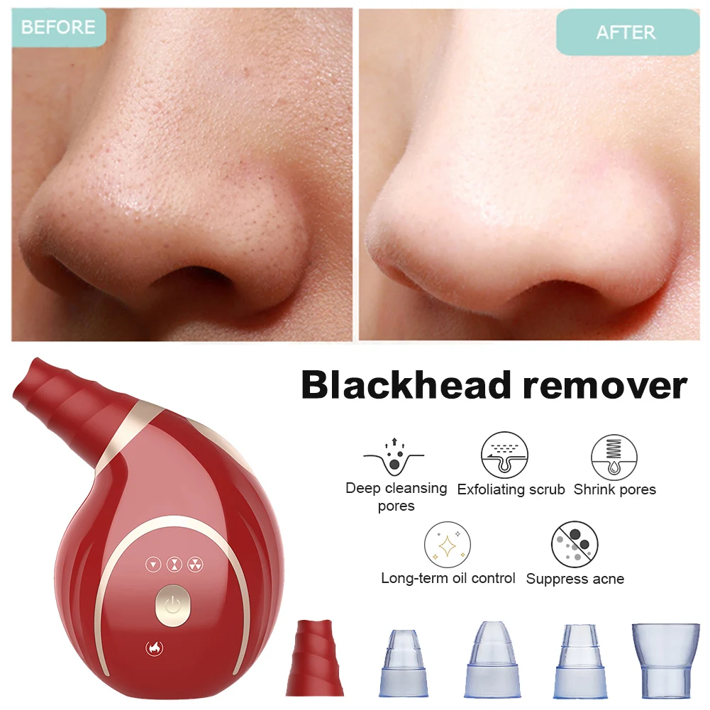Conch Facial Blackhead Remover Electric Acne Cleaner Blackhead Black Point Vacuum Cleaner Tool Black Spots Pore Cleaner Machine
Conch Facial Blackhead Remover Electric Acne Cleaner Blackhead Black Point Vacuum Cleaner Tool Black Spots Pore Cleaner Machine
