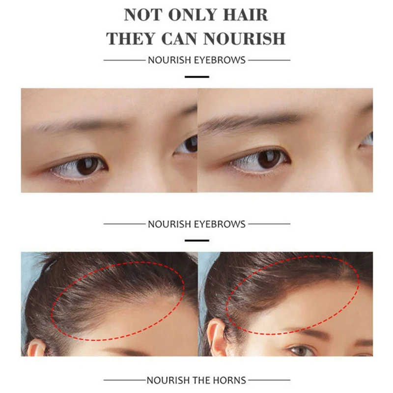 Natural Thick Fast Growth Essence Hair Growth Essential Liquid New Effective Anti Hair Loss Serum
Natural Thick Fast Growth Essence Hair Growth Essential Liquid New Effective Anti Hair Loss Serum