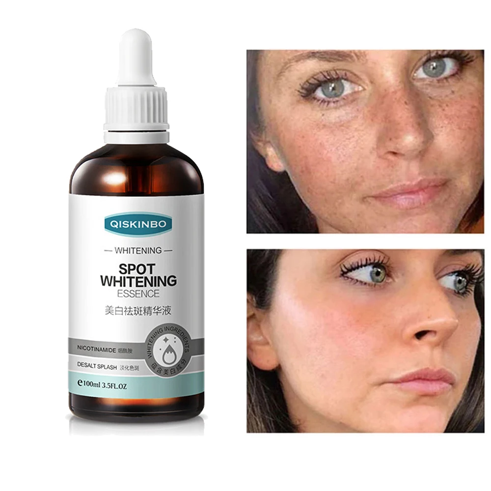 Эссенция для отбеливания веснушек, 100 мл, средство для сужения пор, против выцветания веснушек, пигментации, мелазмы, Осветляющий крем, уход ...
Эссенция для отбеливания веснушек, 100 мл, средство для сужения пор, против выцветания веснушек, пигментации, мелазмы, Осветляющий крем, уход ...