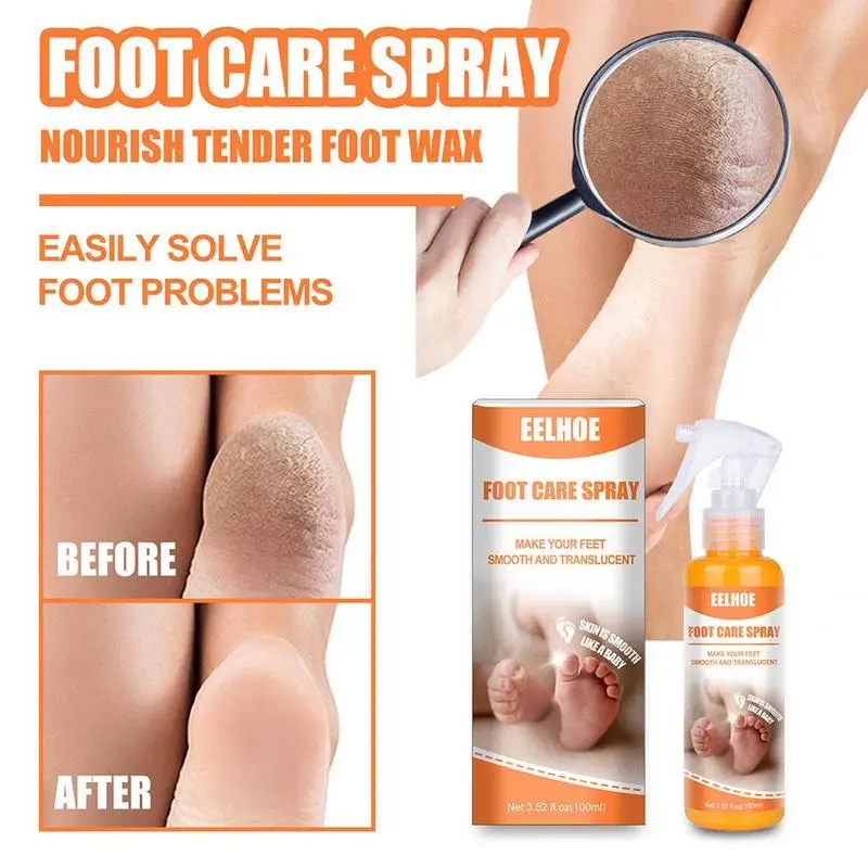 100ml Foot Care Spray Callus Peeling Dry Dead Skin Remover Moisturizing Repairing Sprayer Skin Chapped Socks Feet Pedicure Tools
100ml Foot Care Spray Callus Peeling Dry Dead Skin Remover Moisturizing Repairing Sprayer Skin Chapped Socks Feet Pedicure Tools