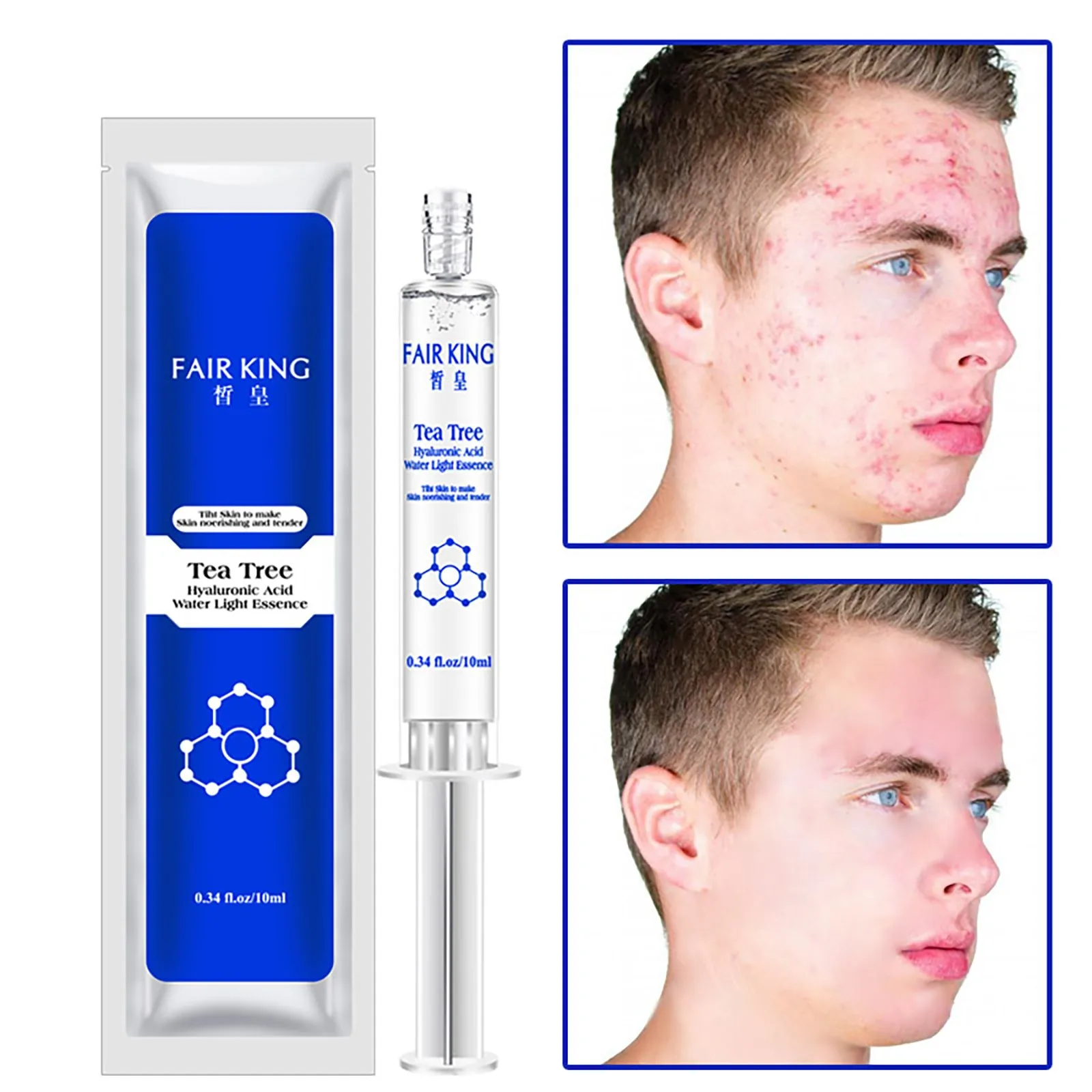 HAICAR Personal Skin Care aqua lifting Acne Treatment Facial Serum Hyaluronic Hydrating Nourishing Serum Firming Hyaluronic Acid
HAICAR Personal Skin Care aqua lifting Acne Treatment Facial Serum Hyaluronic Hydrating Nourishing Serum Firming Hyaluronic Acid