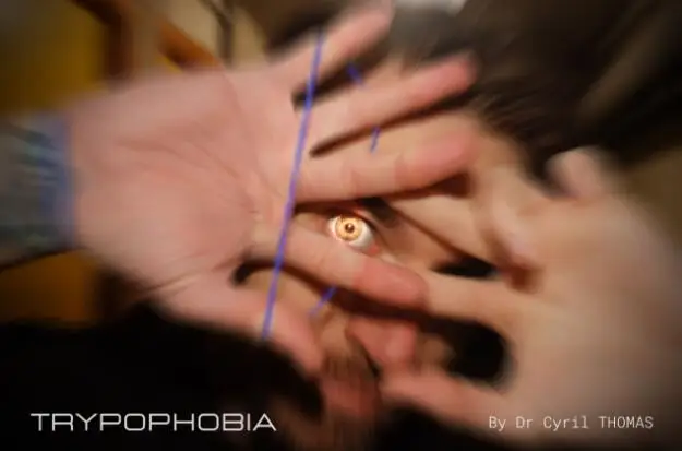 Trypophobia by Dr. Cyril Thomas Magic tricks