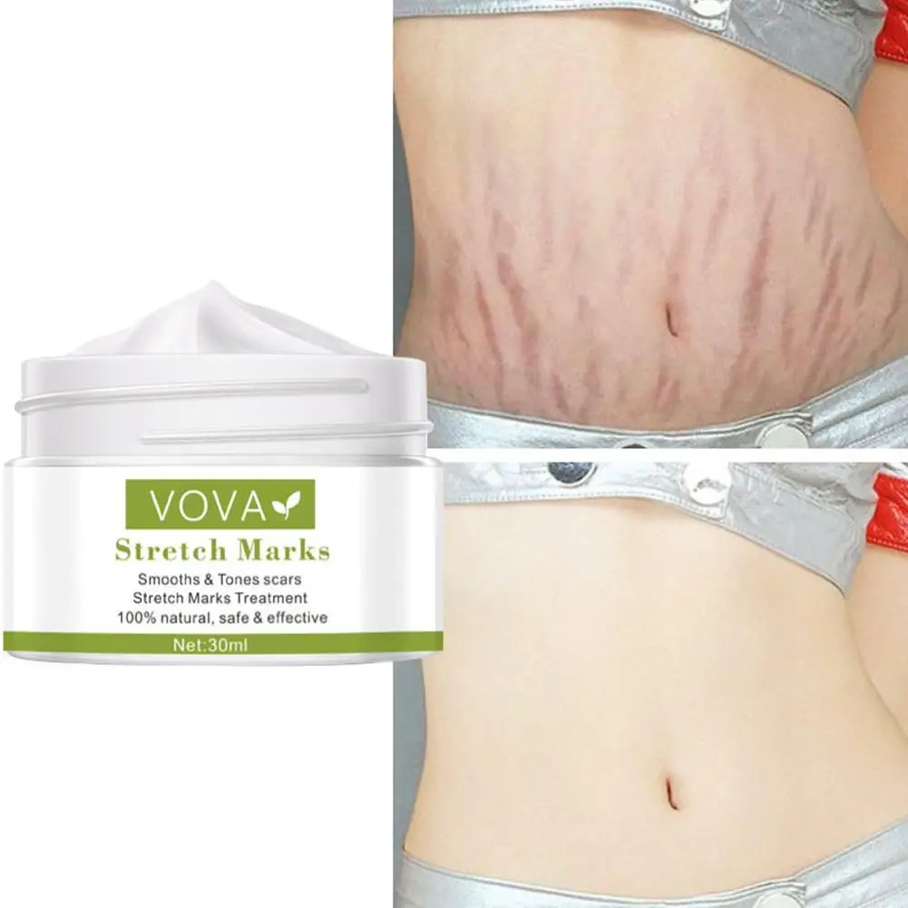 Effective Remove Pregnancy Scars Acne Cream Maternity Repair Anti-Aging Anti-Winkles Firming Body Creams Stretch Marks Treatment
Effective Remove Pregnancy Scars Acne Cream Maternity Repair Anti-Aging Anti-Winkles Firming Body Creams Stretch Marks Treatment