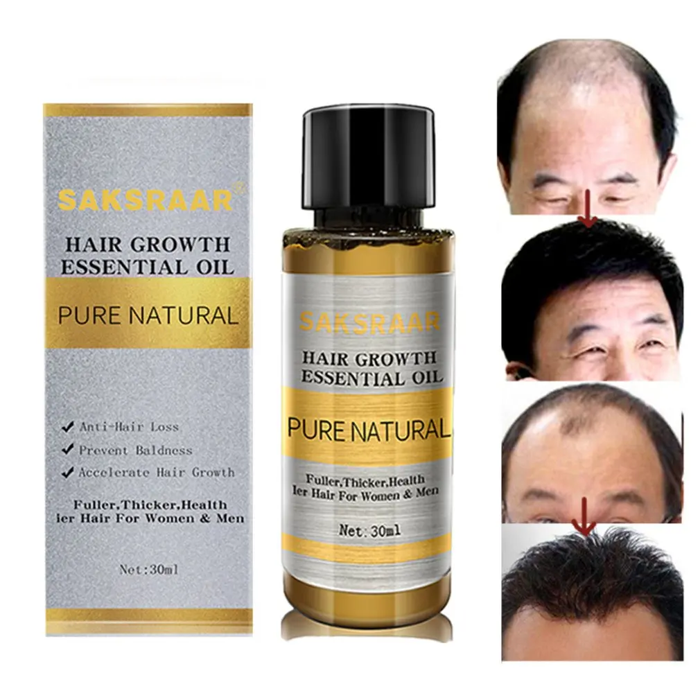 Ginger Hair Care Essence Hair Growth Liquid 30ml Strengthen And Toughen Hair Improve Nutrient Supply Essence
Ginger Hair Care Essence Hair Growth Liquid 30ml Strengthen And Toughen Hair Improve Nutrient Supply Essence