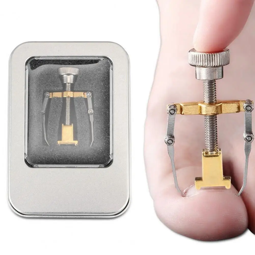 Ingrown Toenail Correction Device Two Colors Pedicure Care Professional Foot Nail Fixer Recover Tool for Foot Treatment
Ingrown Toenail Correction Device Two Colors Pedicure Care Professional Foot Nail Fixer Recover Tool for Foot Treatment