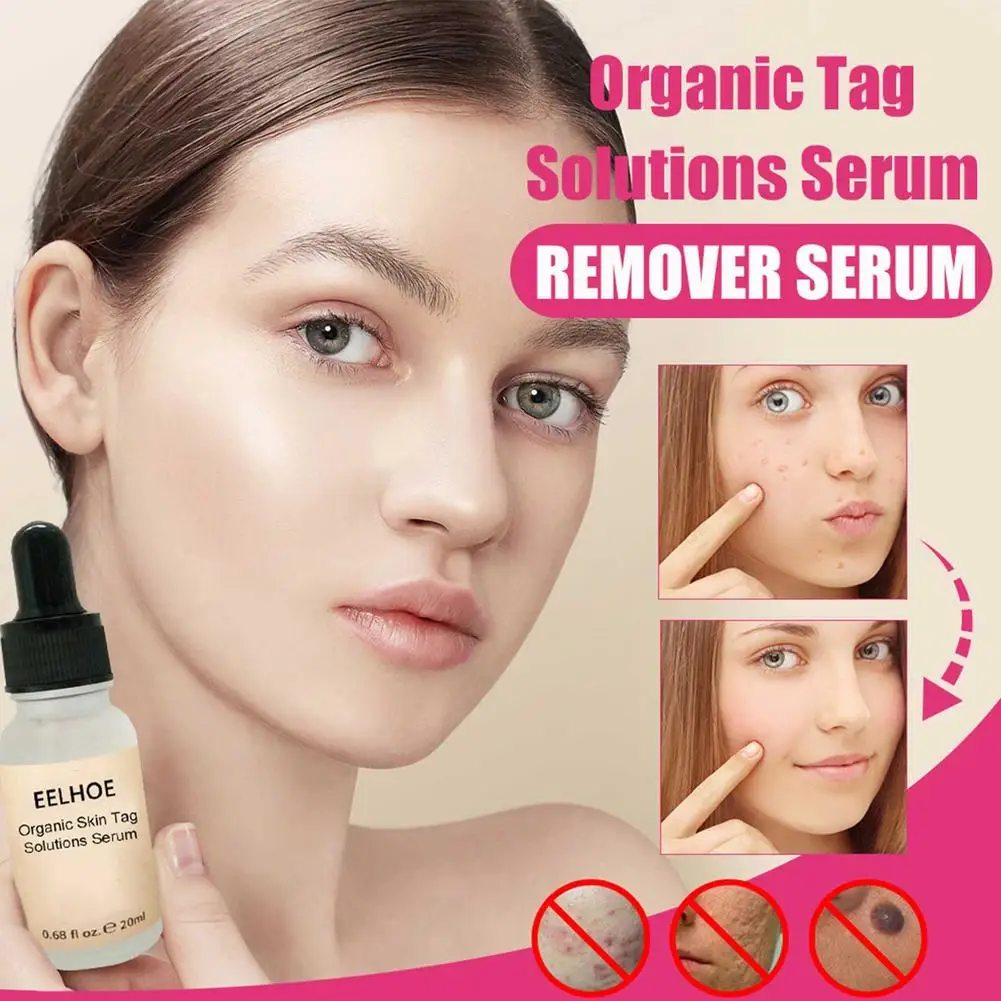 Organic Skin Tag Solutions Serum Natural Skin Purifying Essence Mole Wart Home Use Micro Band Non Toxic Skin Tag Removal Kit
Organic Skin Tag Solutions Serum Natural Skin Purifying Essence Mole Wart Home Use Micro Band Non Toxic Skin Tag Removal Kit