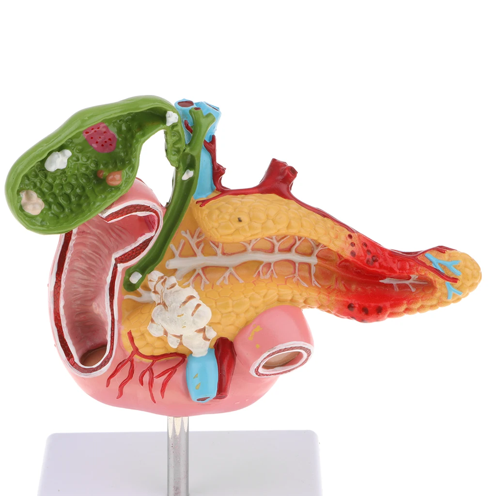Lifesize человеческая желчная пузырь Duodenum патологическая модель с кровью |