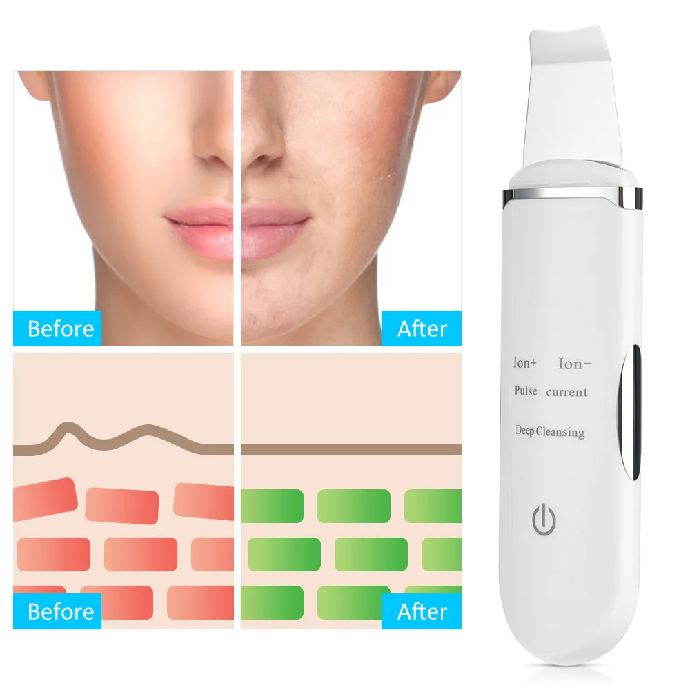 USB charging ultrasonic facial cleaner pore blackhead acne ion skin scraper EMS micro current massage beauty instrument
USB charging ultrasonic facial cleaner pore blackhead acne ion skin scraper EMS micro current massage beauty instrument