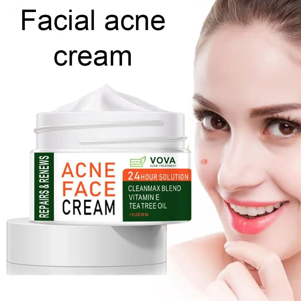 Strong Remove Acne Pimple Whitening Cream Remove Melanin Pimple Care Cream Tool Skin Essence I2M5
Strong Remove Acne Pimple Whitening Cream Remove Melanin Pimple Care Cream Tool Skin Essence I2M5