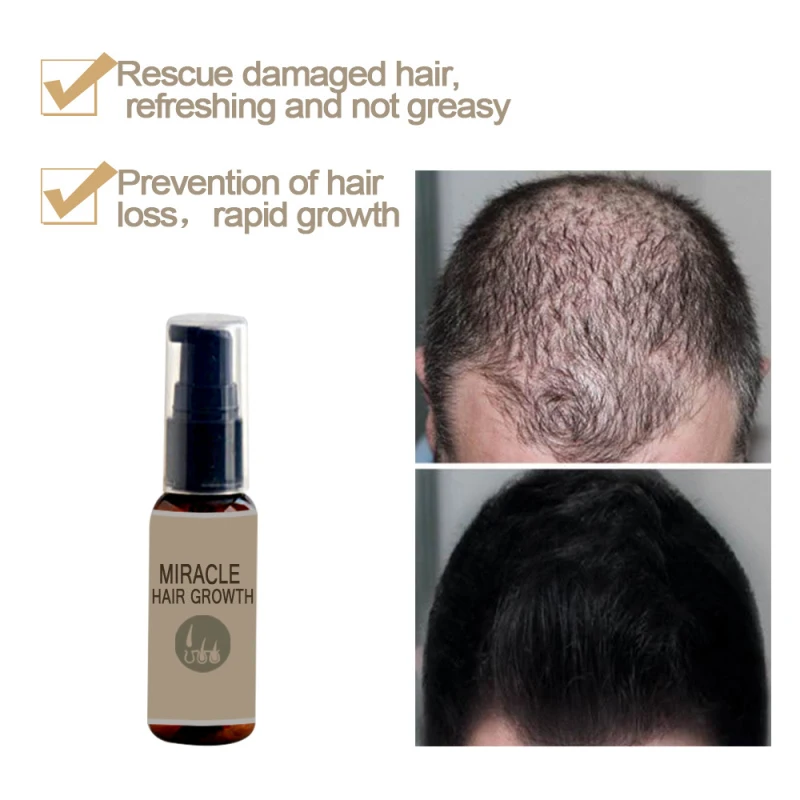 60ML Hair Care Hair Growth Morocco Essential Conditioner Ginger Extract Prevent Hair Loss Hydrating Hair Growth Products TSLM1
60ML Hair Care Hair Growth Morocco Essential Conditioner Ginger Extract Prevent Hair Loss Hydrating Hair Growth Products TSLM1