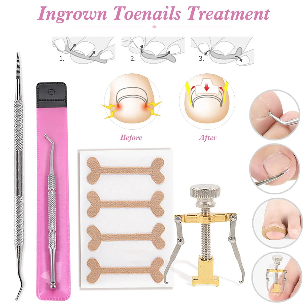 7PCS Ingrown Toenail Tool Kits Toe Nail Lifter Treatment and Dual End Cleaner and File Pedicure Set
7PCS Ingrown Toenail Tool Kits Toe Nail Lifter Treatment and Dual End Cleaner and File Pedicure Set
