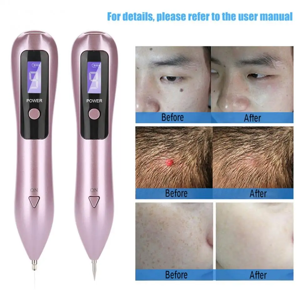 9 level LCD Face Skin Dark Spot Remover Mole Tattoo Removal Laser Plasma Pen Machine Facial Freckle Tag Wart Removal Beauty Care
9 level LCD Face Skin Dark Spot Remover Mole Tattoo Removal Laser Plasma Pen Machine Facial Freckle Tag Wart Removal Beauty Care
