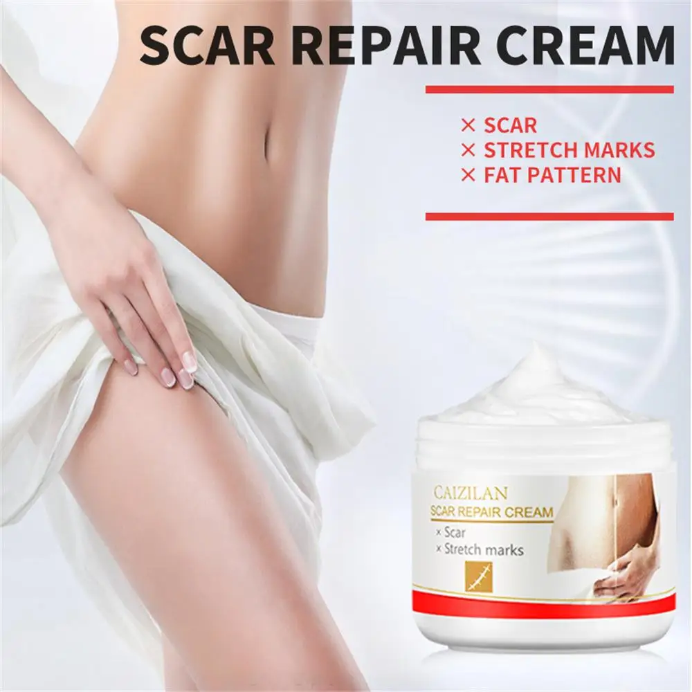 Natural Effective Anti-Stretch Marks Cream Smooth Abdomen Anti-Wrinkle 30g Fashion Women Health Beauty Postpartum Repair Cream
Natural Effective Anti-Stretch Marks Cream Smooth Abdomen Anti-Wrinkle 30g Fashion Women Health Beauty Postpartum Repair Cream
