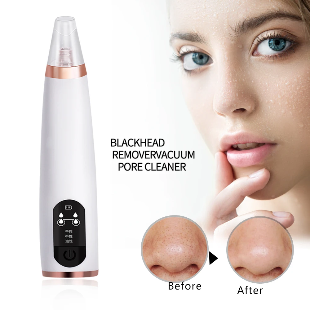 Blackhead Removal Pore Cleansing Skin Care Vacuum Acne Removing Buttons Vacuum Suction Tool Black head Facial Cleaning
Blackhead Removal Pore Cleansing Skin Care Vacuum Acne Removing Buttons Vacuum Suction Tool Black head Facial Cleaning