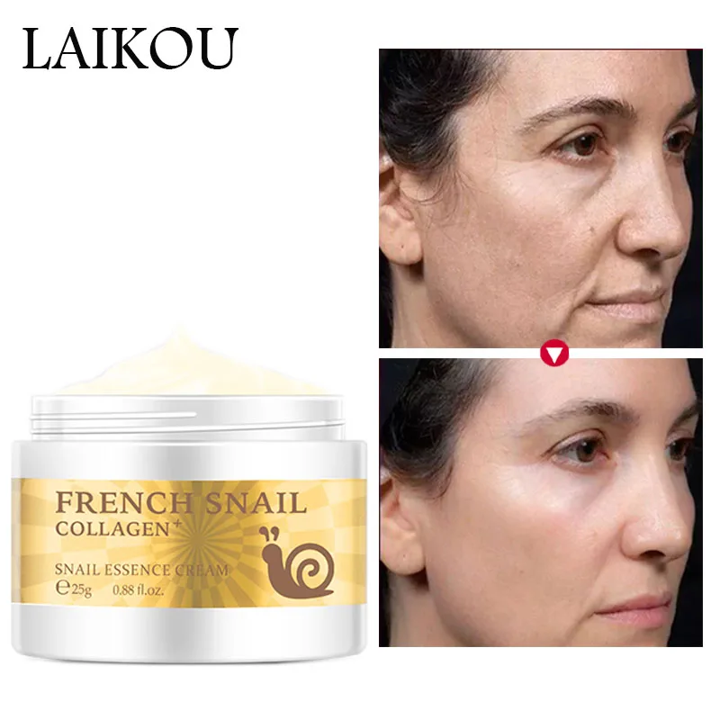 Snail Cream Collagen Firming Lifting Skin Anti-Wrinkle Anti-Aging Whitening Face Cream Hyaluronic Acid Moisturizing Nourishing
Snail Cream Collagen Firming Lifting Skin Anti-Wrinkle Anti-Aging Whitening Face Cream Hyaluronic Acid Moisturizing Nourishing