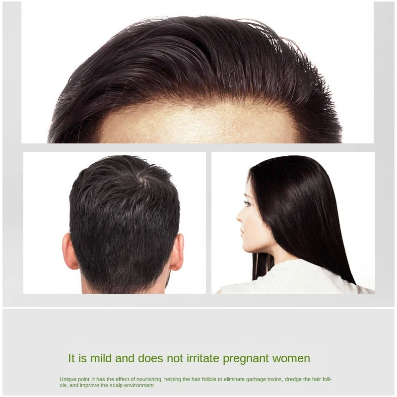 30ml Hair Growth Serum Essence Anti Hair Loss Repair Damaged Serum Oil Growing Faster Nutritious for Men Women
30ml Hair Growth Serum Essence Anti Hair Loss Repair Damaged Serum Oil Growing Faster Nutritious for Men Women