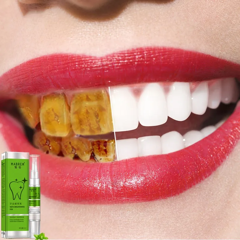 Magic Teeth Whitening Pen Removing Yellow Teeth Tooth Cleaning Pen Dazzling White Smile
Magic Teeth Whitening Pen Removing Yellow Teeth Tooth Cleaning Pen Dazzling White Smile