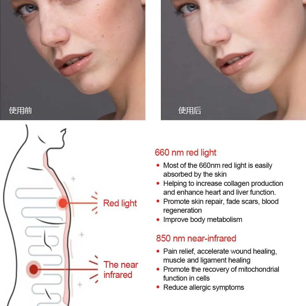 90W LED Body Beauty Lamp Freckle Rejuvenation Pain Skin Repairs Scar Accelerated Wounds Healing Physical Therapy Infrared Lights
90W LED Body Beauty Lamp Freckle Rejuvenation Pain Skin Repairs Scar Accelerated Wounds Healing Physical Therapy Infrared Lights