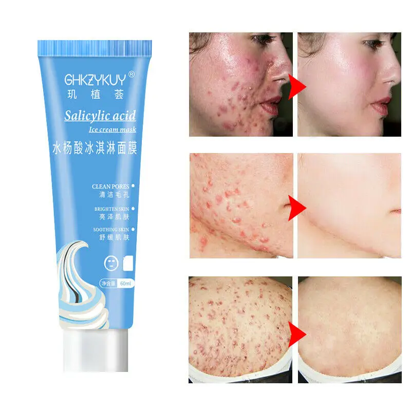 60g Salicylic Acid Ultra Cleansing Mask Ice Cream Facial Mask Reduce Acne Marks and Blackheads Moisturizing Whitening face care
60g Salicylic Acid Ultra Cleansing Mask Ice Cream Facial Mask Reduce Acne Marks and Blackheads Moisturizing Whitening face care