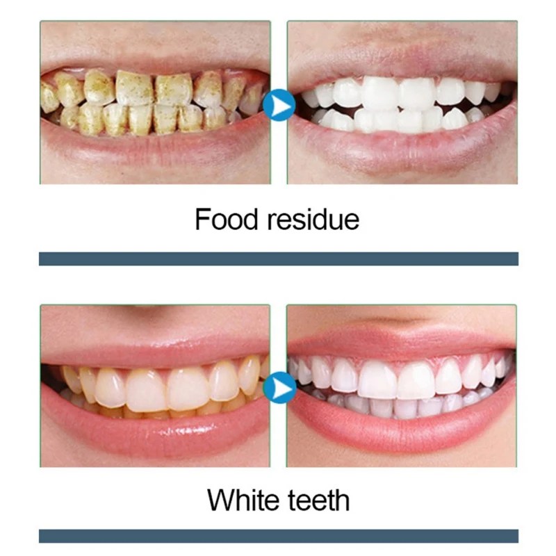 50g Bamboo Charcoal Tooth Whitening Powder Activated Coconut Natural Teeth Whitening Charcoal Oral Hygiene Powder
50g Bamboo Charcoal Tooth Whitening Powder Activated Coconut Natural Teeth Whitening Charcoal Oral Hygiene Powder