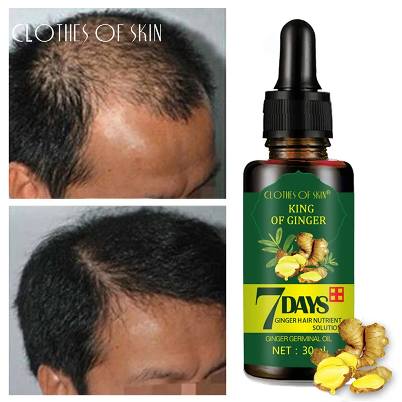 7 Days Ginger Hair Growth Serum Germinal Hair Growth Essence Oil Hair Loss Treatement Growth Hair for Thin hair Men Women 30ML
7 Days Ginger Hair Growth Serum Germinal Hair Growth Essence Oil Hair Loss Treatement Growth Hair for Thin hair Men Women 30ML