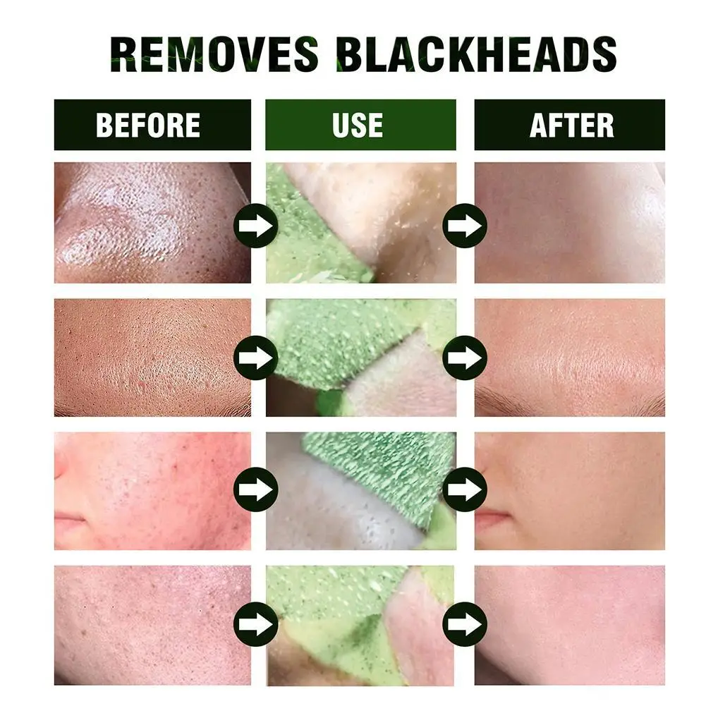 100g Green Tea Cleansing Mud Film Deep Clean Face Mask Repair Control Moisturizing Skin Pores Oil Shrink Care Whitening Tool
100g Green Tea Cleansing Mud Film Deep Clean Face Mask Repair Control Moisturizing Skin Pores Oil Shrink Care Whitening Tool