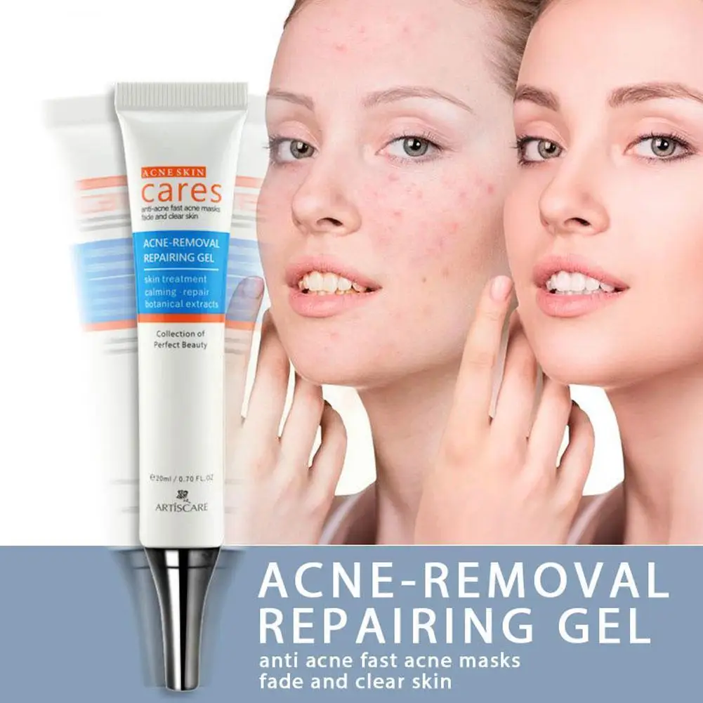 1pc Whitening Acne Cream 20ml Remove Acne Marks And Acne Essence Scar Dullness Gel Acne Melanin L9M5
1pc Whitening Acne Cream 20ml Remove Acne Marks And Acne Essence Scar Dullness Gel Acne Melanin L9M5