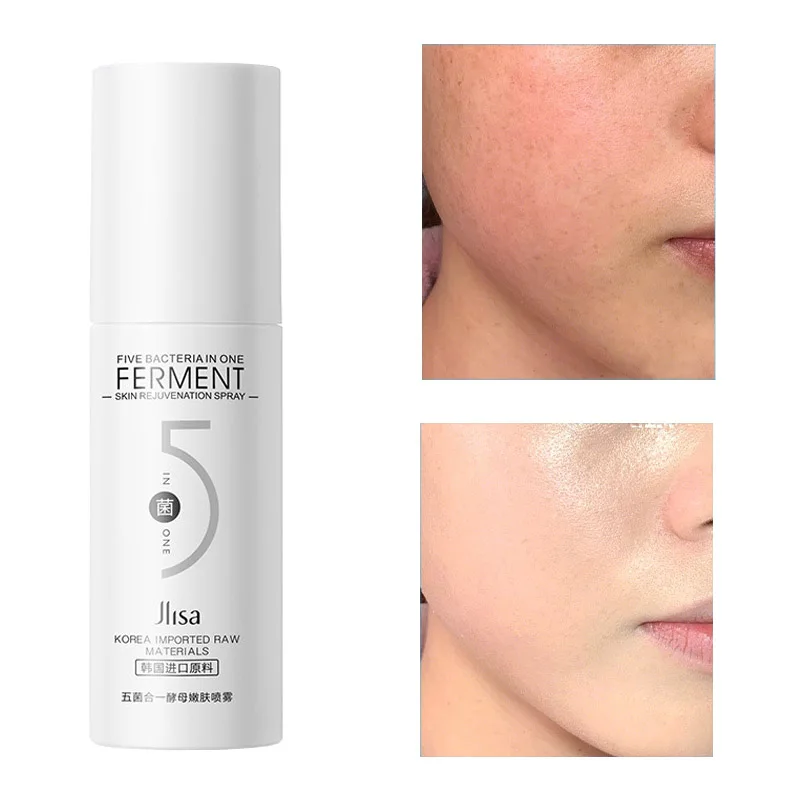 Yeast Toner Spray 100ML Moisturizing Refreshing Whitening Brightening Anti Dry Repair Face Skin Care Tonic Remove Ance Womens P
Yeast Toner Spray 100ML Moisturizing Refreshing Whitening Brightening Anti Dry Repair Face Skin Care Tonic Remove Ance Womens P