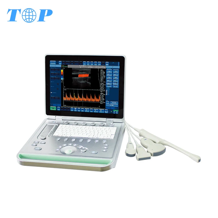 TOP-A1054 portable diagnostic ultrasound machine price / portable ultrasound scanner price china
TOP-A1054 portable diagnostic ultrasound machine price / portable ultrasound scanner price china
