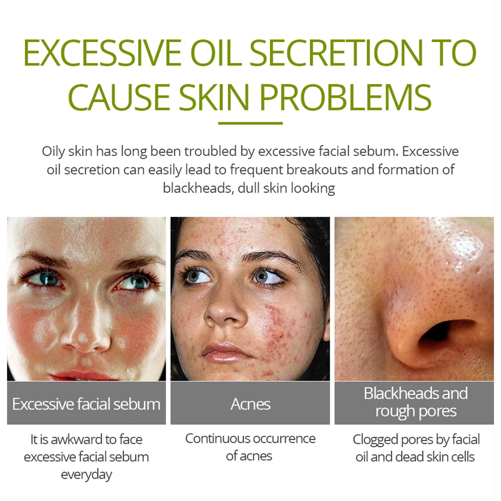 Tea Tree Acne Face Cream Treatment Acne Scar Shrink Pores Oil Control Facial Skin Care Whitening Moisturizing
Tea Tree Acne Face Cream Treatment Acne Scar Shrink Pores Oil Control Facial Skin Care Whitening Moisturizing