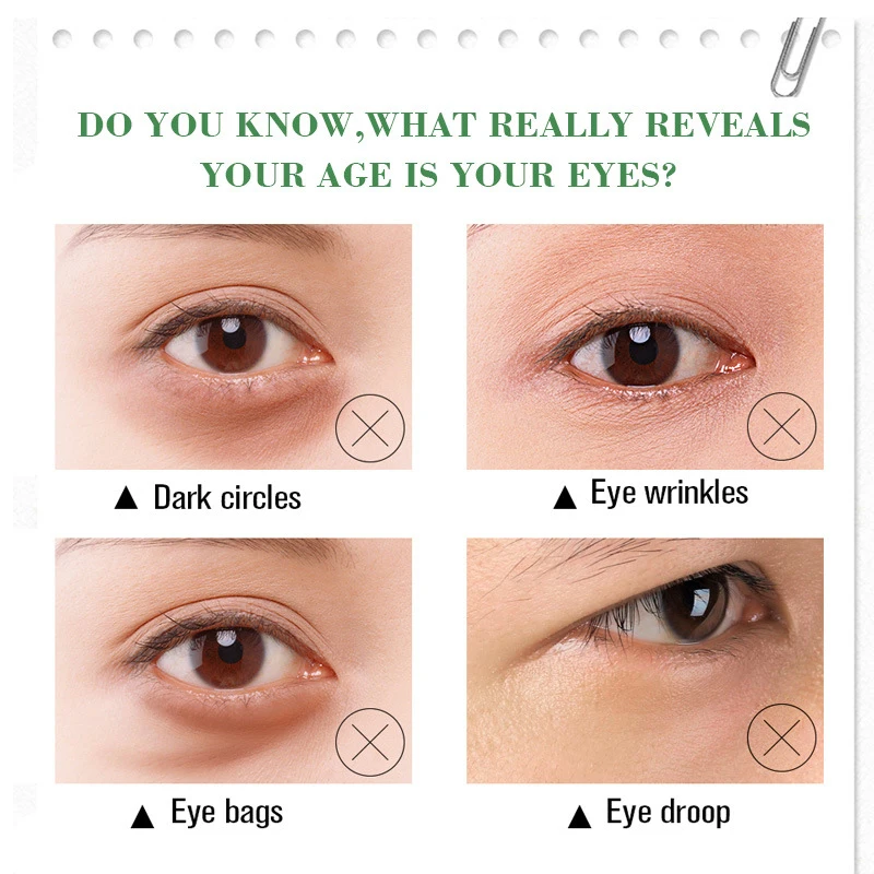 Melasma Acne Spot Pigment Melanin Dark Spots Pigmentation Moisturizing Gel Skin Care Effective Whitening Freckle Cream Remove
Melasma Acne Spot Pigment Melanin Dark Spots Pigmentation Moisturizing Gel Skin Care Effective Whitening Freckle Cream Remove