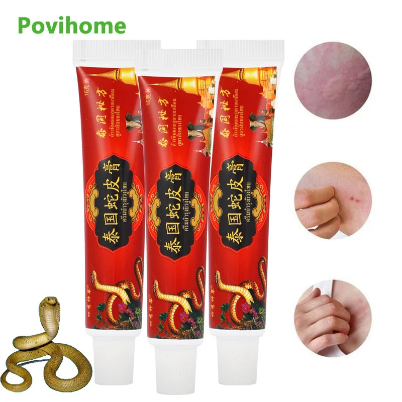 1/2/3pcs 16g Thailand Snake Venom Eczema Anti-itch Cream Psoriasis Urticaria Treatment Ointment Dermatitis Herbal Skin Cream
1/2/3pcs 16g Thailand Snake Venom Eczema Anti-itch Cream Psoriasis Urticaria Treatment Ointment Dermatitis Herbal Skin Cream