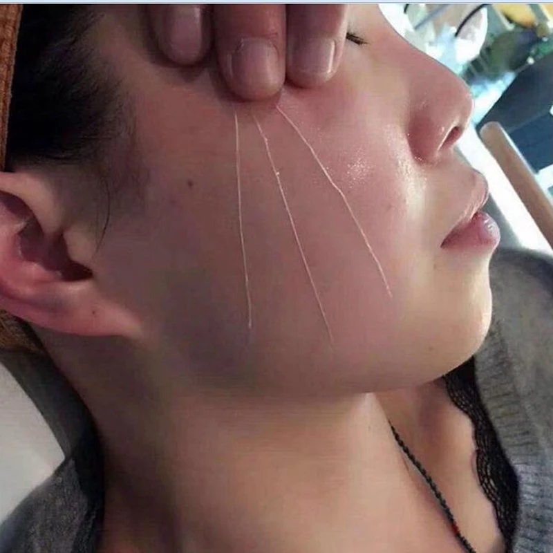 Face Filler Absorbable Collagen Based Protein Thread FaceLift Silk Fbroin Line Carving Essence Face Care Skin Rejuvenating
Face Filler Absorbable Collagen Based Protein Thread FaceLift Silk Fbroin Line Carving Essence Face Care Skin Rejuvenating