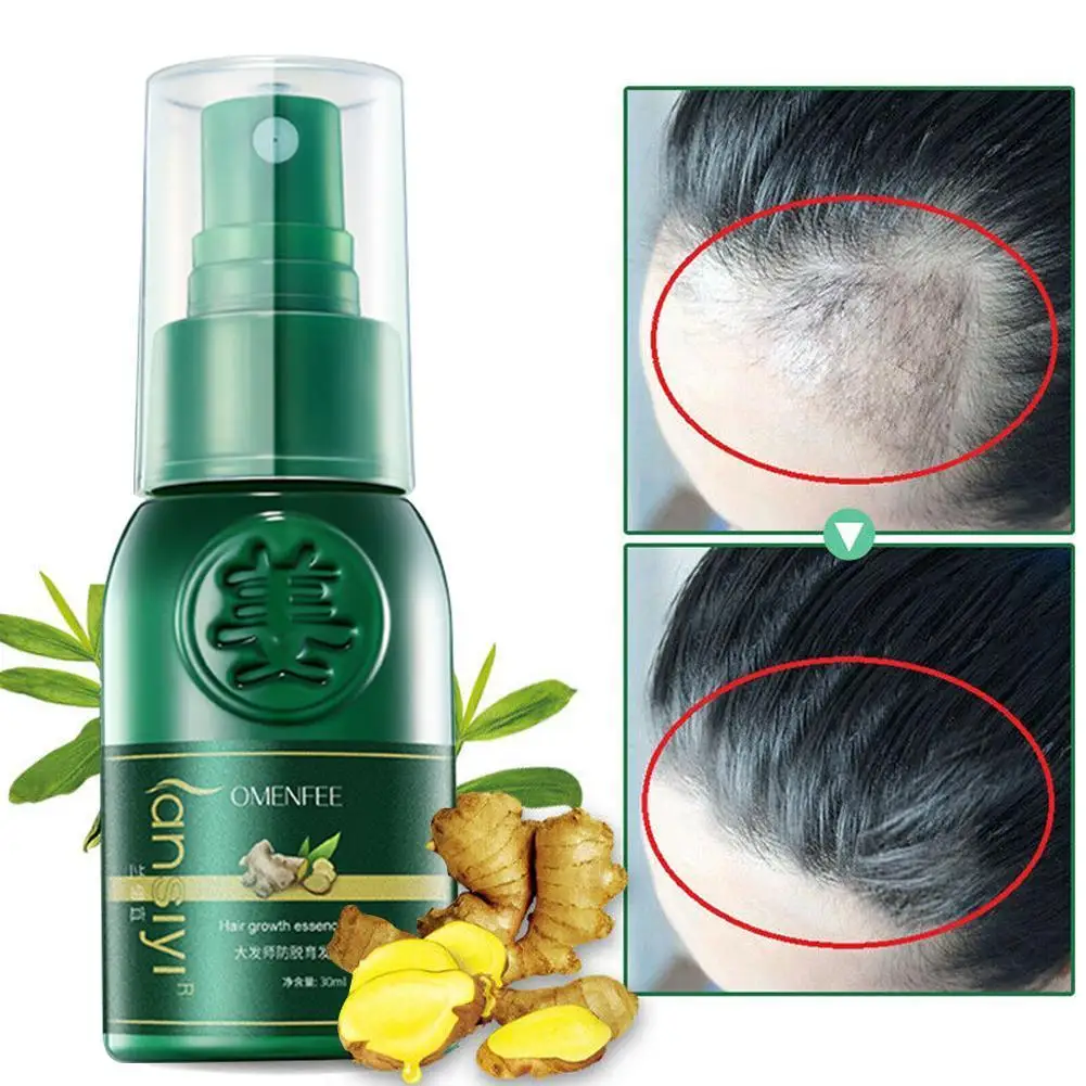 

Effective Ginger Hair Growth Spray Ointment Damaged Nutrition Hair 30ml Cream Loss Healthy Anti-Hair Essence Care Hair Oil