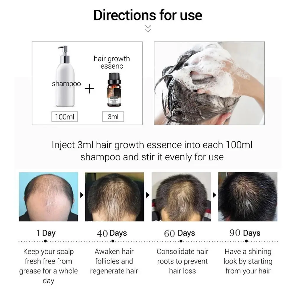 Hair Care Hair Growth Essential Oils Essence Hair Loss Liquid Beauty Dense Hair Growth Serum Nourishing Treatment Health Care
Hair Care Hair Growth Essential Oils Essence Hair Loss Liquid Beauty Dense Hair Growth Serum Nourishing Treatment Health Care