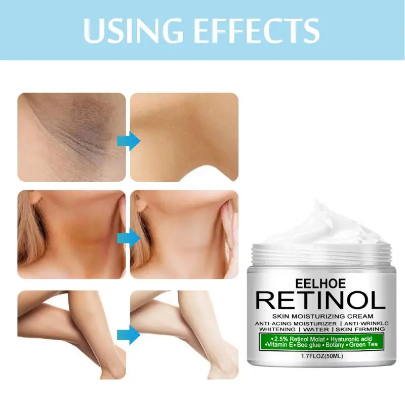 50g Whitening Cream Bleaching Body Lightening Cream Underarm Armpit Whitening Cream Legs Knees Private Parts Body White TSLM1
50g Whitening Cream Bleaching Body Lightening Cream Underarm Armpit Whitening Cream Legs Knees Private Parts Body White TSLM1