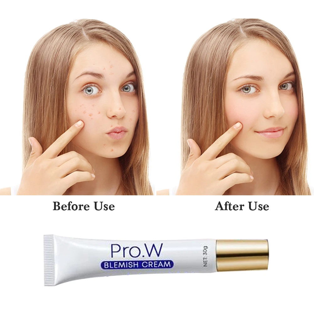 Pro.w 1Pc Face Acne Treatment and Spot-Removing Cream Blackhead Removal Water-Oil Balance Shrink Pores Blemish Cream Skin Care
Pro.w 1Pc Face Acne Treatment and Spot-Removing Cream Blackhead Removal Water-Oil Balance Shrink Pores Blemish Cream Skin Care