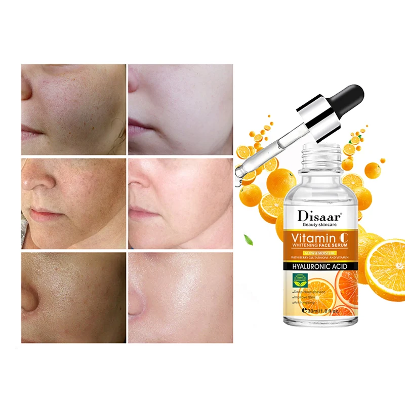 Сыворотка для лица VC, Антивозрастная, отбеливающая, увлажняющая эссенция для лица
Сыворотка для лица VC, Антивозрастная, отбеливающая, увлажняющая эссенция для лица