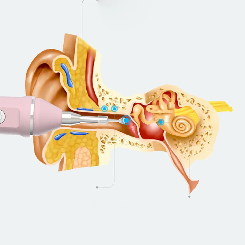 Visual Earwax Spoon Earwax Stick Ear Wax Cleaning Spoon Electric Earwax Spoon )