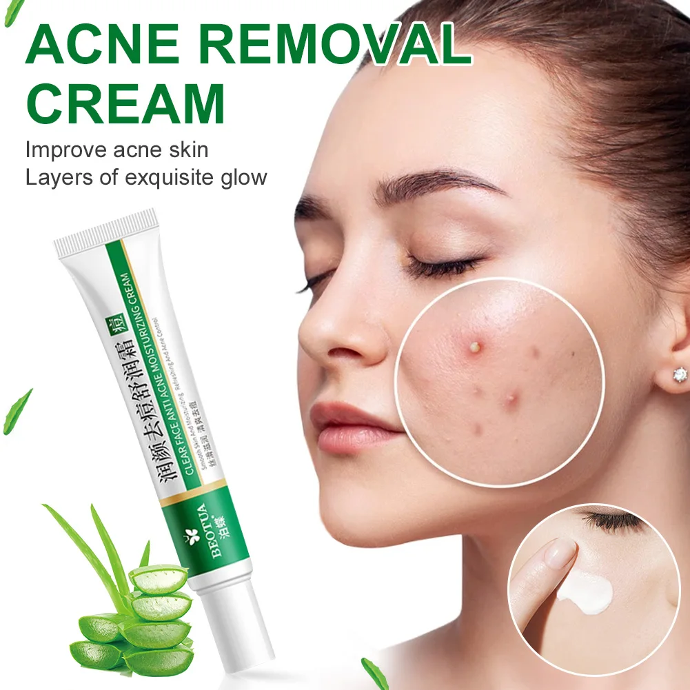 Effective Acne Removal Cream Repair Fade Acne Spots Shrink Pores Soothing Moisturizing Treatment Cream Skin Care Fast delivery
Effective Acne Removal Cream Repair Fade Acne Spots Shrink Pores Soothing Moisturizing Treatment Cream Skin Care Fast delivery
