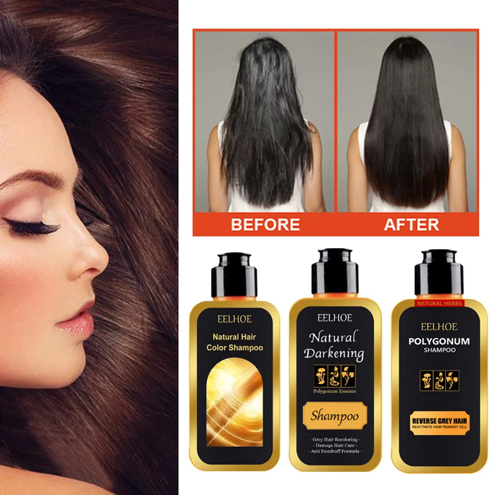 shampoo Natural plant extract Hair darkening Hair care Essence plant essence Repair necrotic hair follicles Promote hair growth
shampoo Natural plant extract Hair darkening Hair care Essence plant essence Repair necrotic hair follicles Promote hair growth