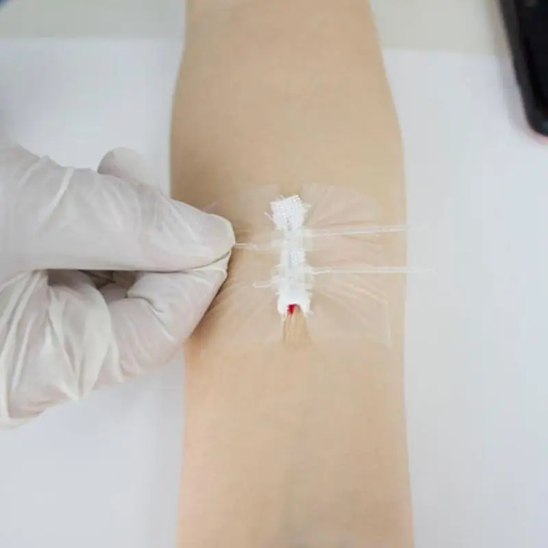 Zipper Tie Wound Closure Patch Hemostatic Patch Wound Suture Zipper Portable Fast Outdoor Band-Aid S0T3
Zipper Tie Wound Closure Patch Hemostatic Patch Wound Suture Zipper Portable Fast Outdoor Band-Aid S0T3