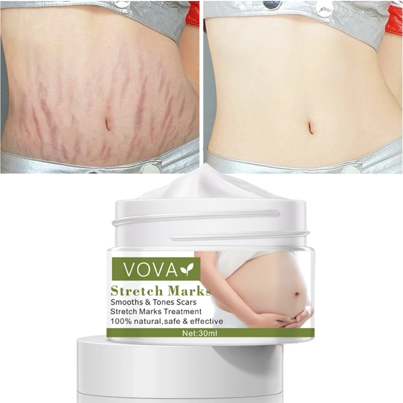 VOVA Effective Remove Pregnancy Scars Acne Cream Stretch Marks Treatment Maternity Repair Anti-Aging Anti-Winkles Firming Body
VOVA Effective Remove Pregnancy Scars Acne Cream Stretch Marks Treatment Maternity Repair Anti-Aging Anti-Winkles Firming Body