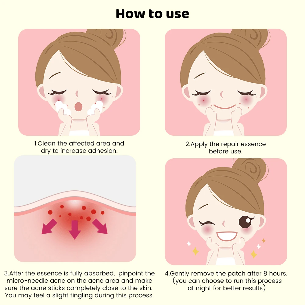 Translucent Microneedle Pimple Patch Acne Soothing patch Fast Healing Zit Stickers Blemish Treatment Skin Treatment fast ship
Translucent Microneedle Pimple Patch Acne Soothing patch Fast Healing Zit Stickers Blemish Treatment Skin Treatment fast ship
