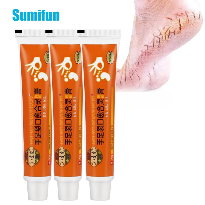 

1/3pcs Chinese Herbs Crack Foot Cream Foot Care Anti-Drying Heel Cracked Repair Oil Cream Removal Dead Skin Feet Ointment 30g