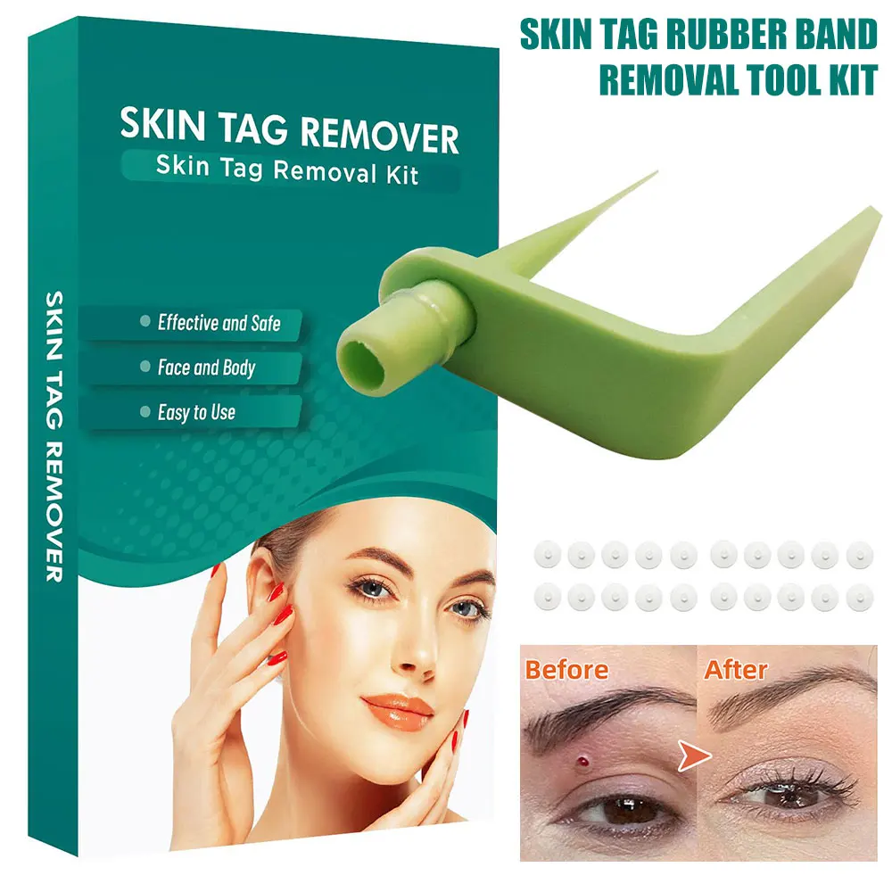Skin Tag Remover Kit Home Use Mole Wart Remover Safe and Painless Face Care Mole Wart Skin Tag Remover Skin Care Tool Non-toxic
Skin Tag Remover Kit Home Use Mole Wart Remover Safe and Painless Face Care Mole Wart Skin Tag Remover Skin Care Tool Non-toxic